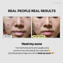 Jumiso Snail Mucin 95 + Peptide Essence 140ml 4